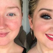 14 Redness-Reducing Products I Swear By Since Being Diagnosed With Rosacea