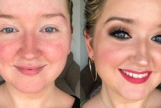 14 Redness-Reducing Products I Swear By Since Being Diagnosed With Rosacea