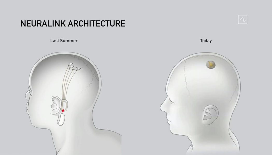 Elon Musk trots out pigs in demo of Neuralink brain implants