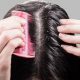 Get Rid Of Dandruff Naturally With These Remedies