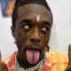 Lil Uzi Vert Appears to Have Re-Implanted His $24 Million Forehead Diamond