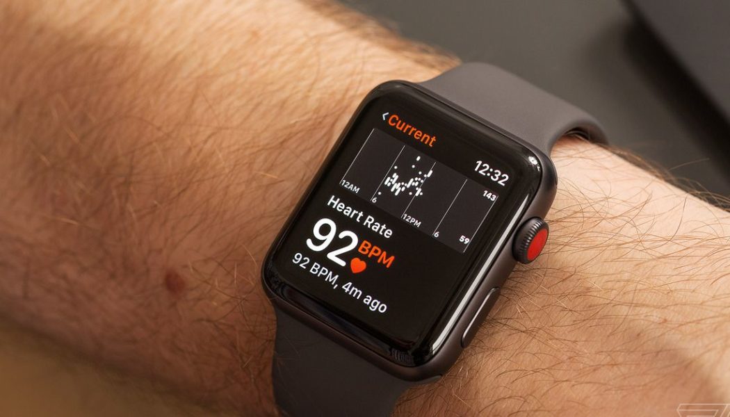 Apple Watch flags multiple types of irregular heartbeats, study shows