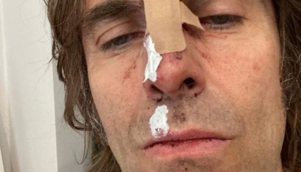 Liam Gallagher Says He Fell Out of a Helicopter