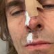 Liam Gallagher Says He Fell Out of a Helicopter