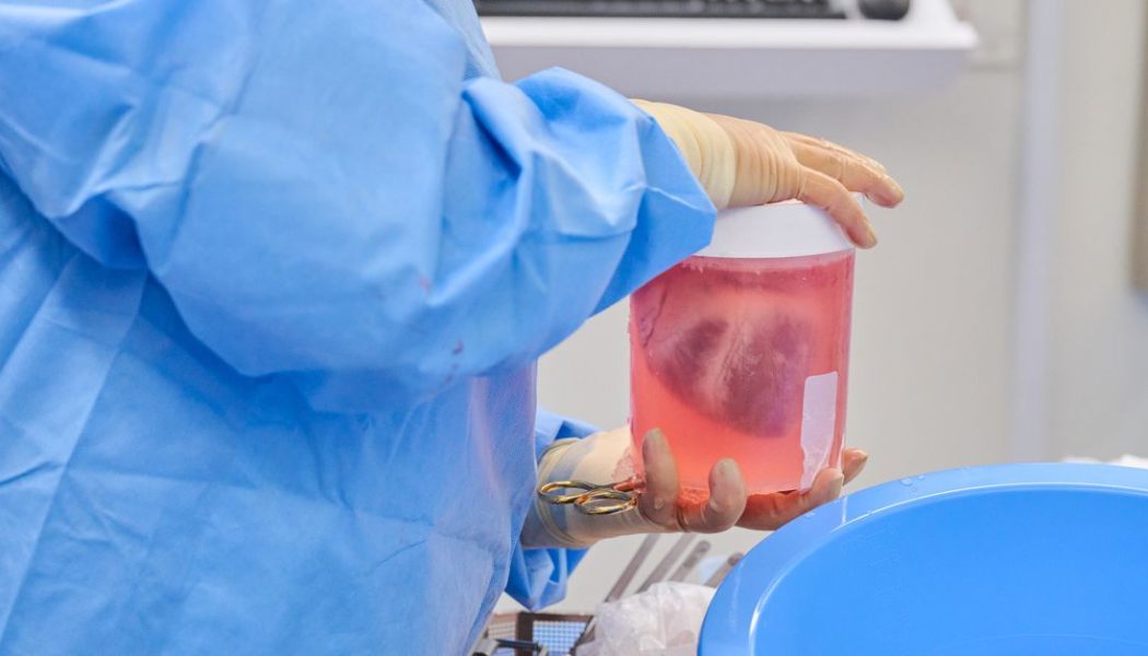 Genetically engineered pig hearts transplanted into dead people