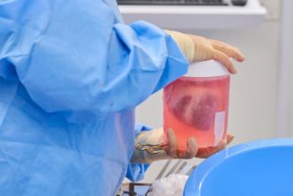 Genetically engineered pig hearts transplanted into dead people