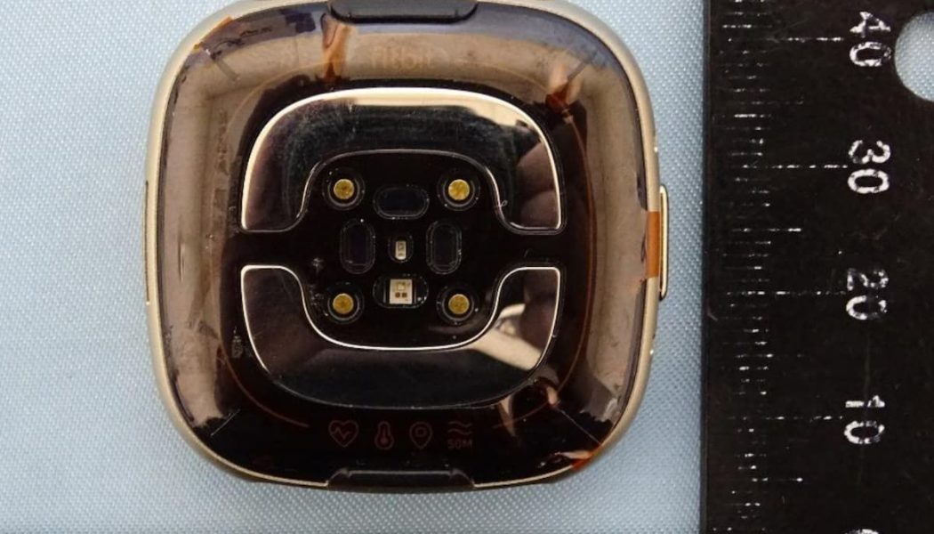 Leaked Fitbit Sense 2 photos show the capacitive button is dead