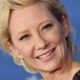 Anne Heche Remains in a Coma Following Car Crash