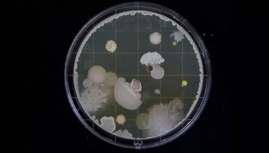 Biologist Music Producer Creates First Living Record With Yeast Cells