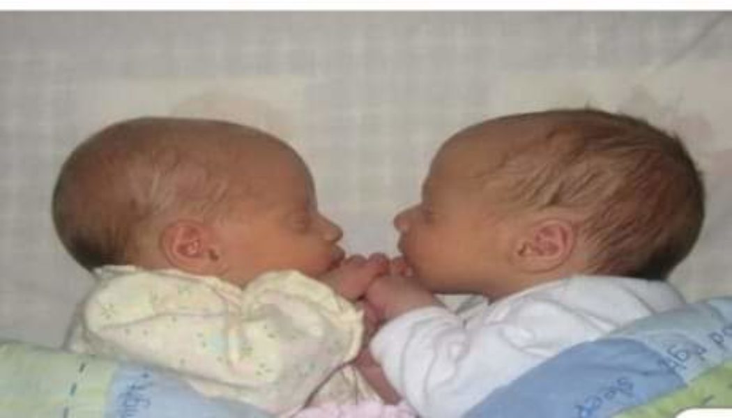 Brazilian Woman Gives Birth To Twins With Different Biological Fathers,