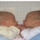 Brazilian Woman Gives Birth To Twins With Different Biological Fathers,