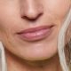 Dermatologists Say These 6 Treatments Are Best for Lip Lines