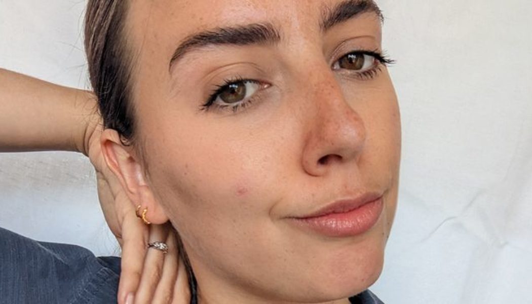 I Have Dark Under-Eye Circles—These Are the Only 11 Concealers That Work for Me