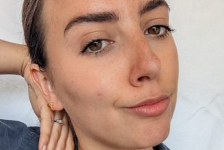 I Have Dark Under-Eye Circles—These Are the Only 11 Concealers That Work for Me