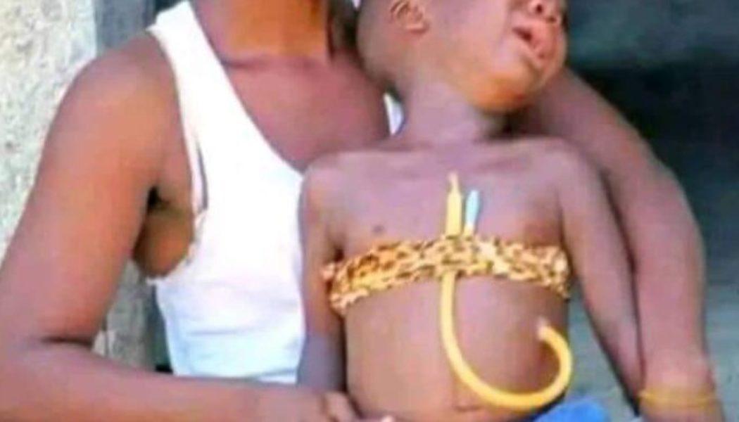 Father Seeks ₦500,000 For 10-year-old Son’s Surgery