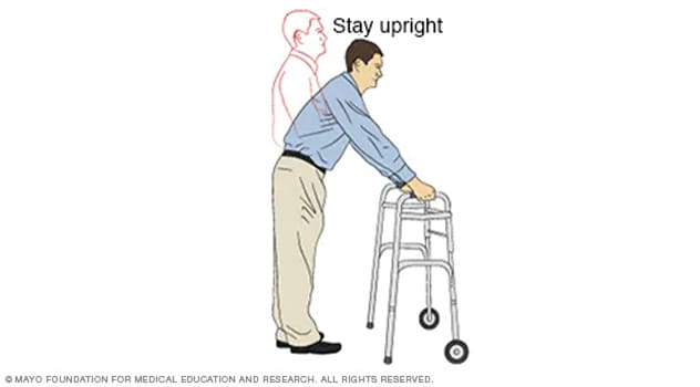 Illustration of a person using a walker incorrectly