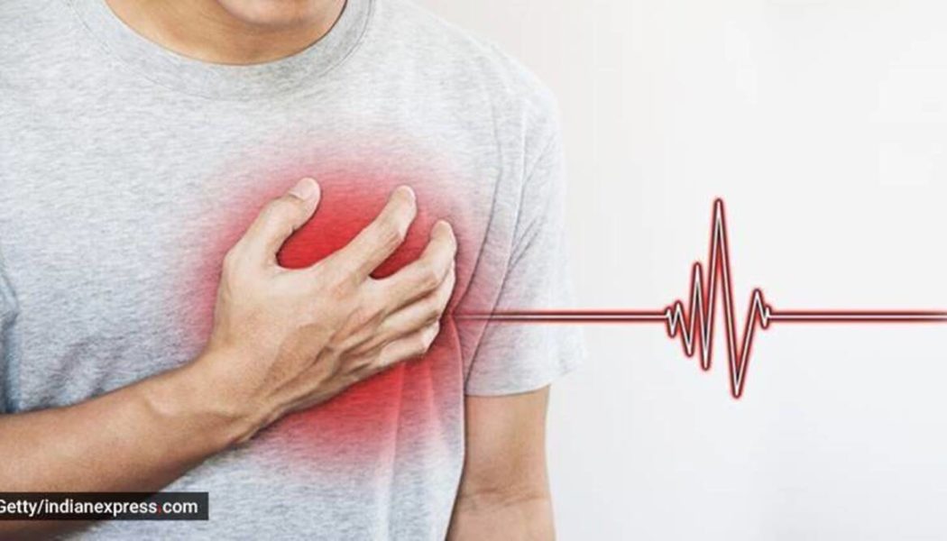 Are you more likely to have a serious heart attack on a Monday?