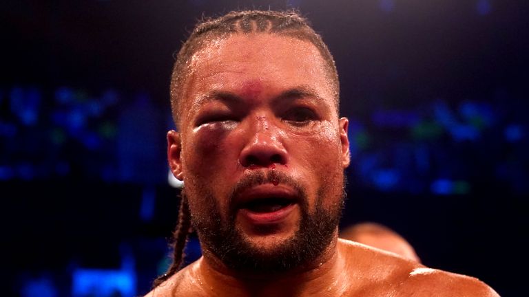 Joe Joyce&#39;s eye was damaged in the Zhilei Zhang fight, but not fractured