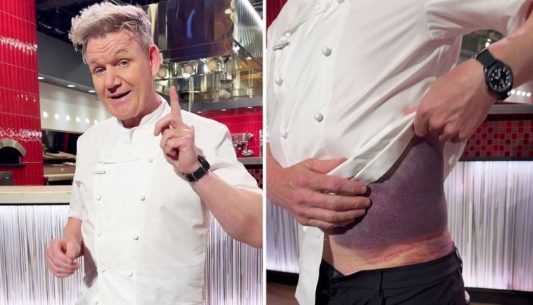 Gordon Ramsay is “lucky to be here” after bad bicycle accident