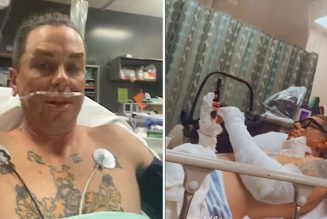 Slipknot's Sid Wilson suffers serious burns in accident