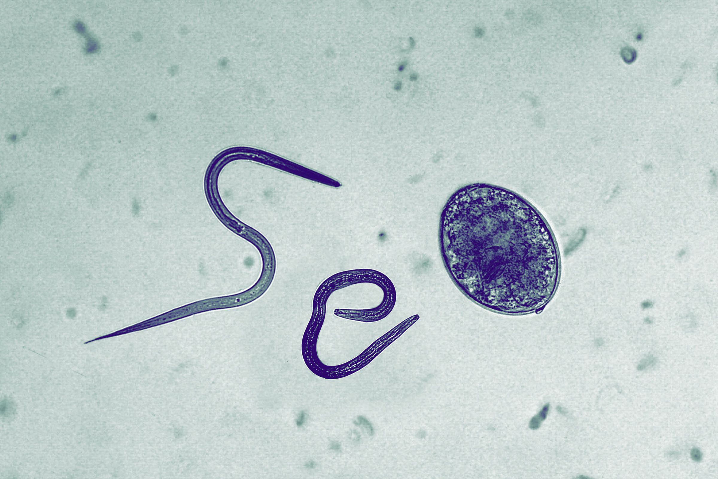 Microscopic photo collage of parasitic worms spelling “SEO”.